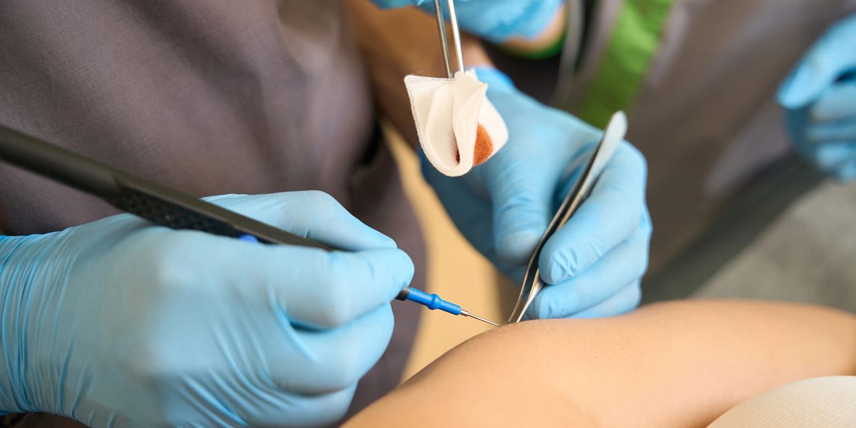 Dr. Gougian performing a minor medical procedure in the clinic.